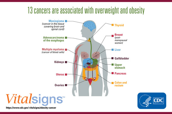 p1003-vs-obesity-cancer