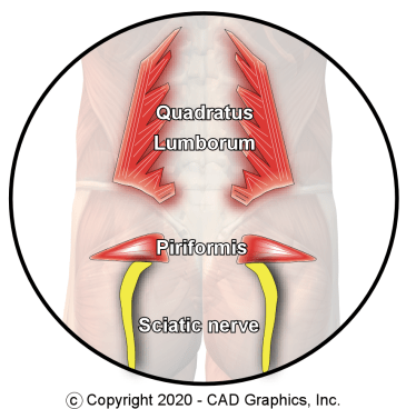 Quadratus Lumborum graphic