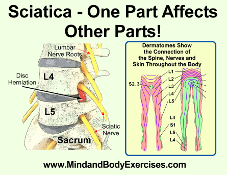 sciatica-one part affects other parts
