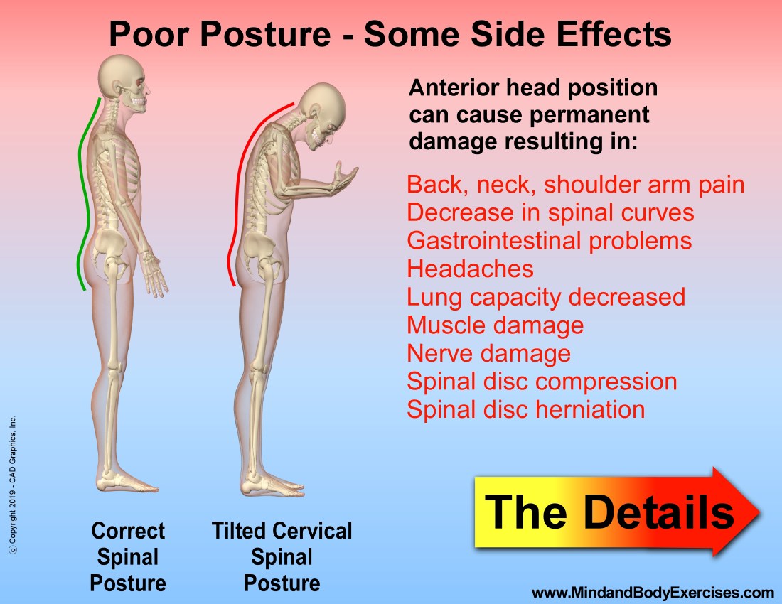 Poor Posture &amp; methods to Counterbalance-slide1