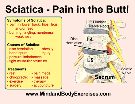 sciatica-causes &amp; treatment graphic